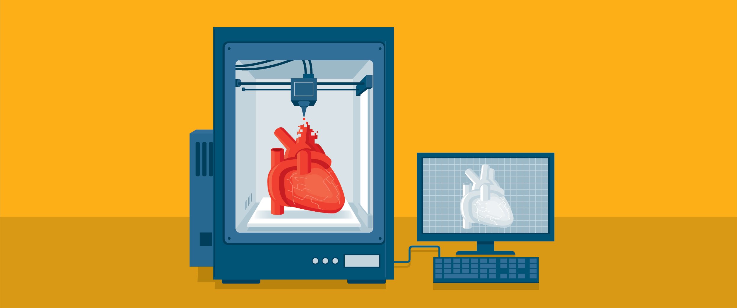 3D printing a heart for organ transplant