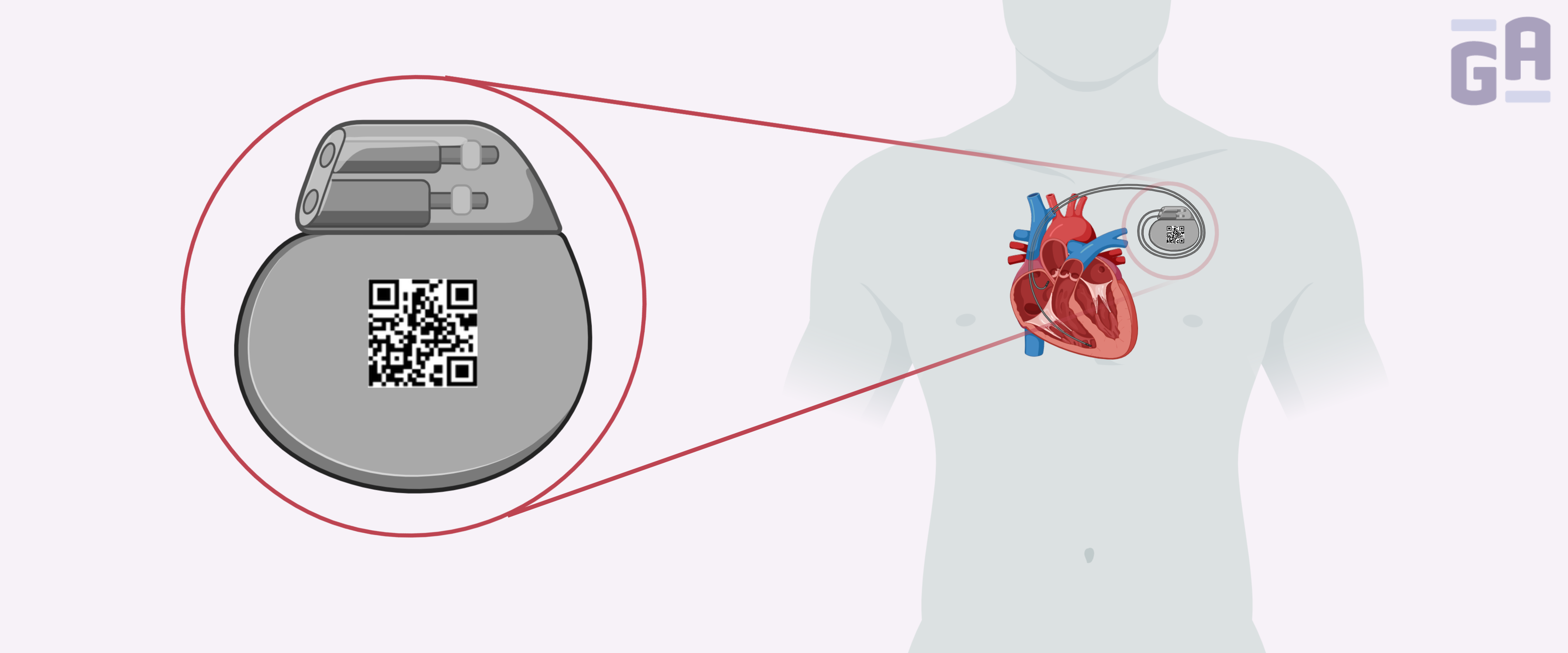 0040 - UDI regulations