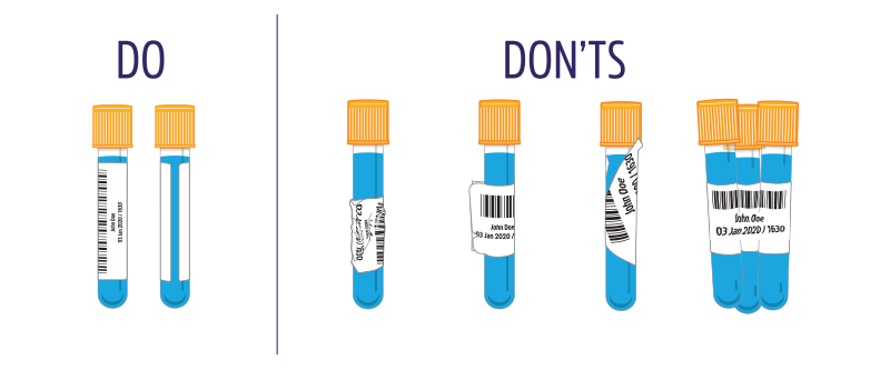 Specimen labeling best practices