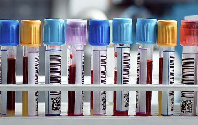 Barcode labeled vacutainer tubes