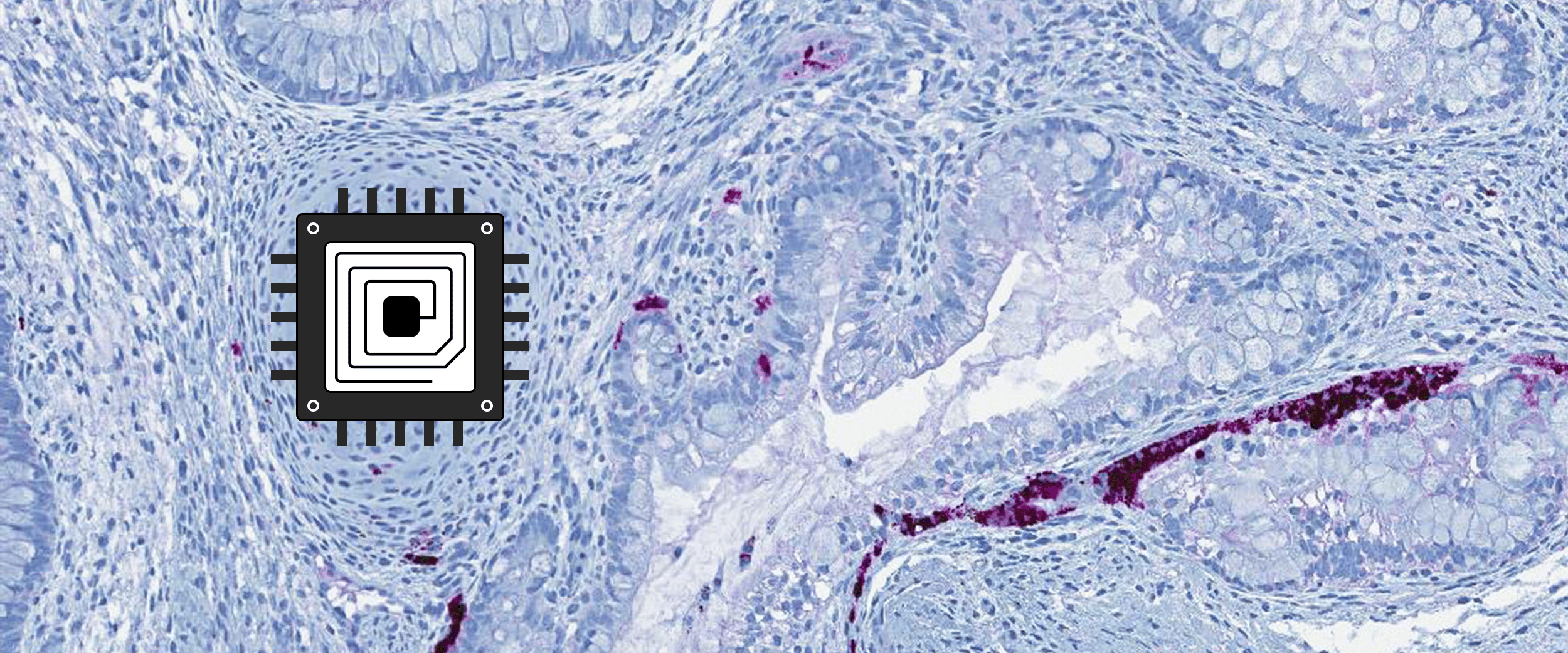 AI medical diagnostics